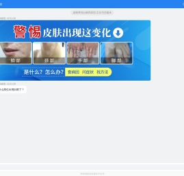 西昌白癜风医院