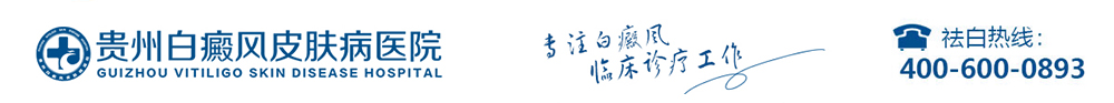 安顺白癜风