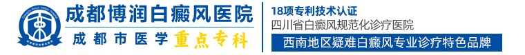 成都白癜风医院